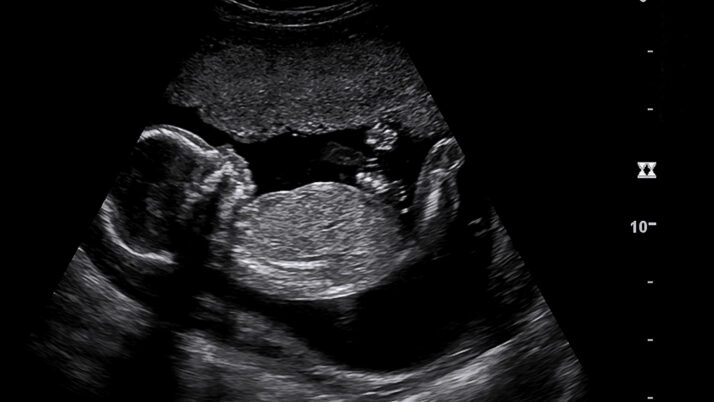 Abortion Employee Quits After Seeing Ultrasound