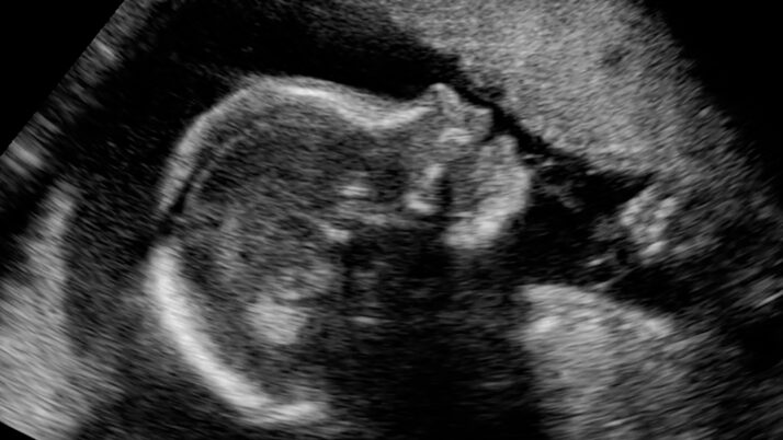The most effective way to expose abortionists’ lies to mothers