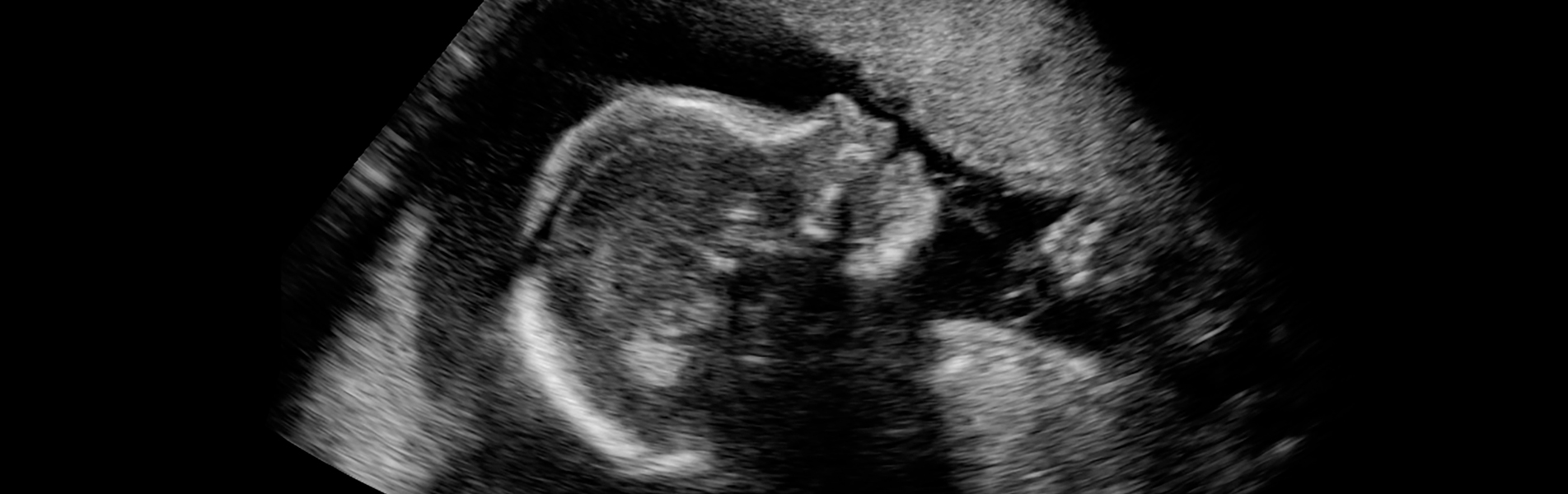 Abortion lobby’s lies exposed