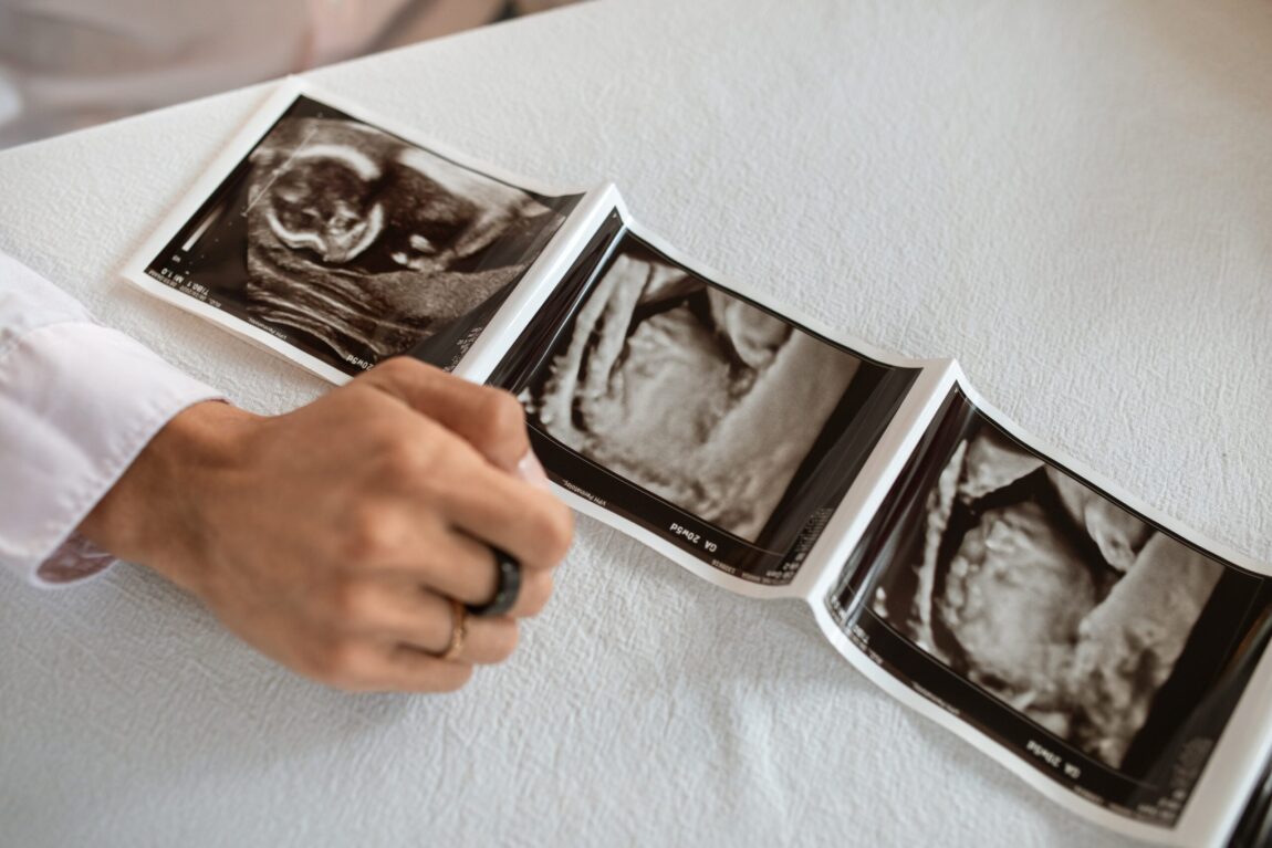 A most powerful tool for humanizing the unborn