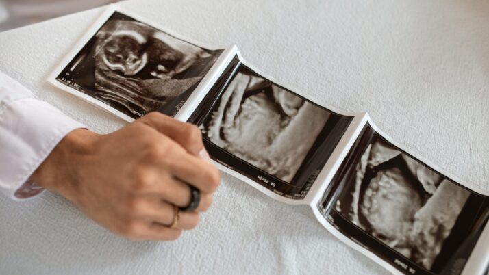 A most powerful tool for humanizing the unborn