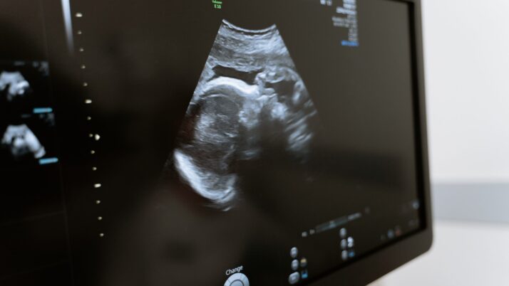 Another Ultrasound Success Story